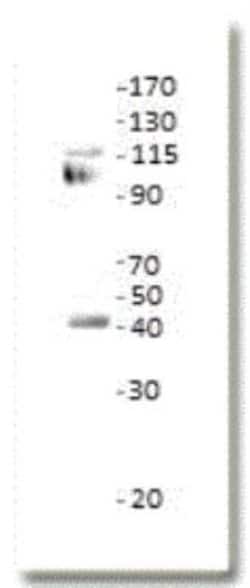 ETS1 associated protein II Antibody, Novus Biologicals:Antibodies:Primary